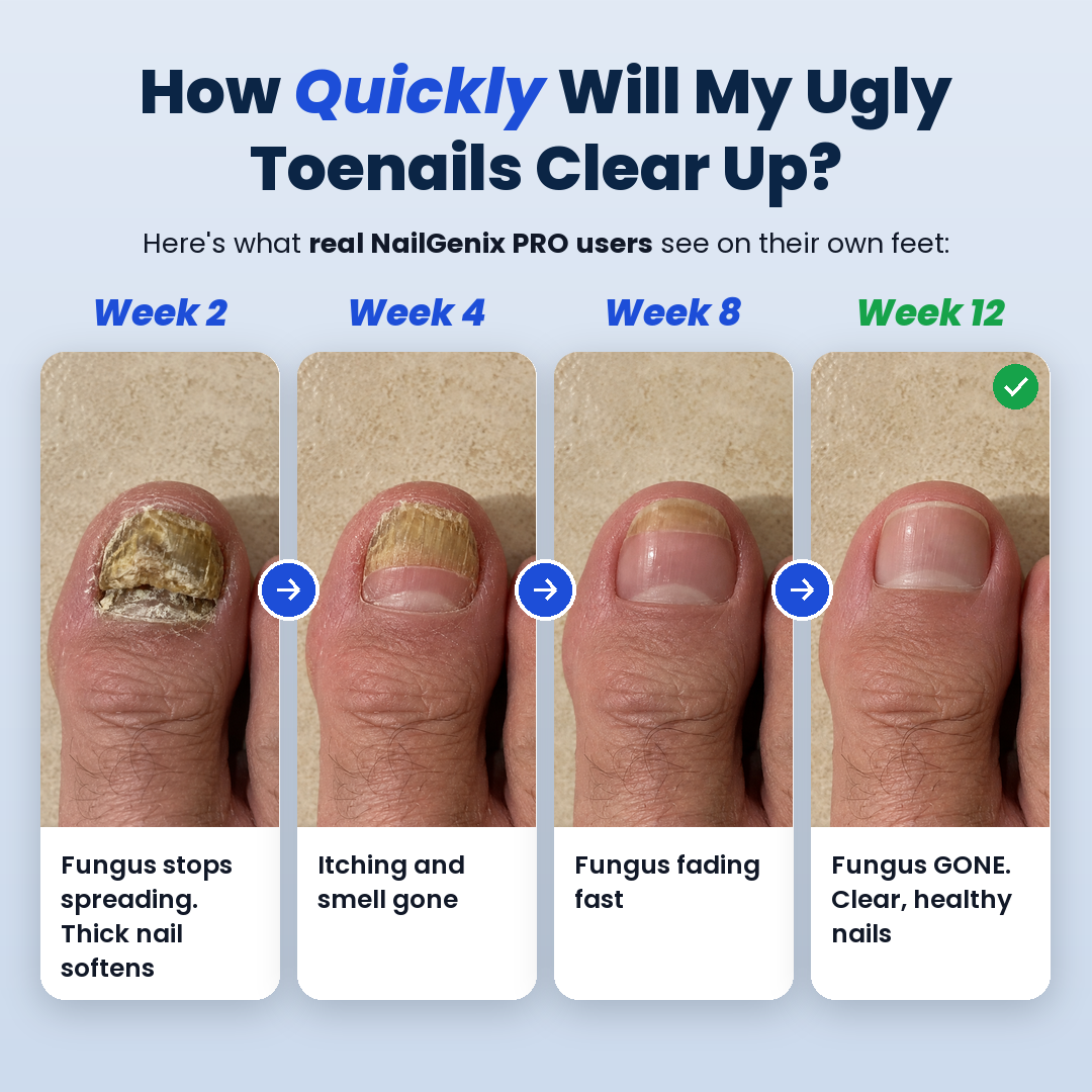 NailGenix Pro