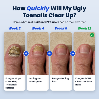 NailGenix Pro